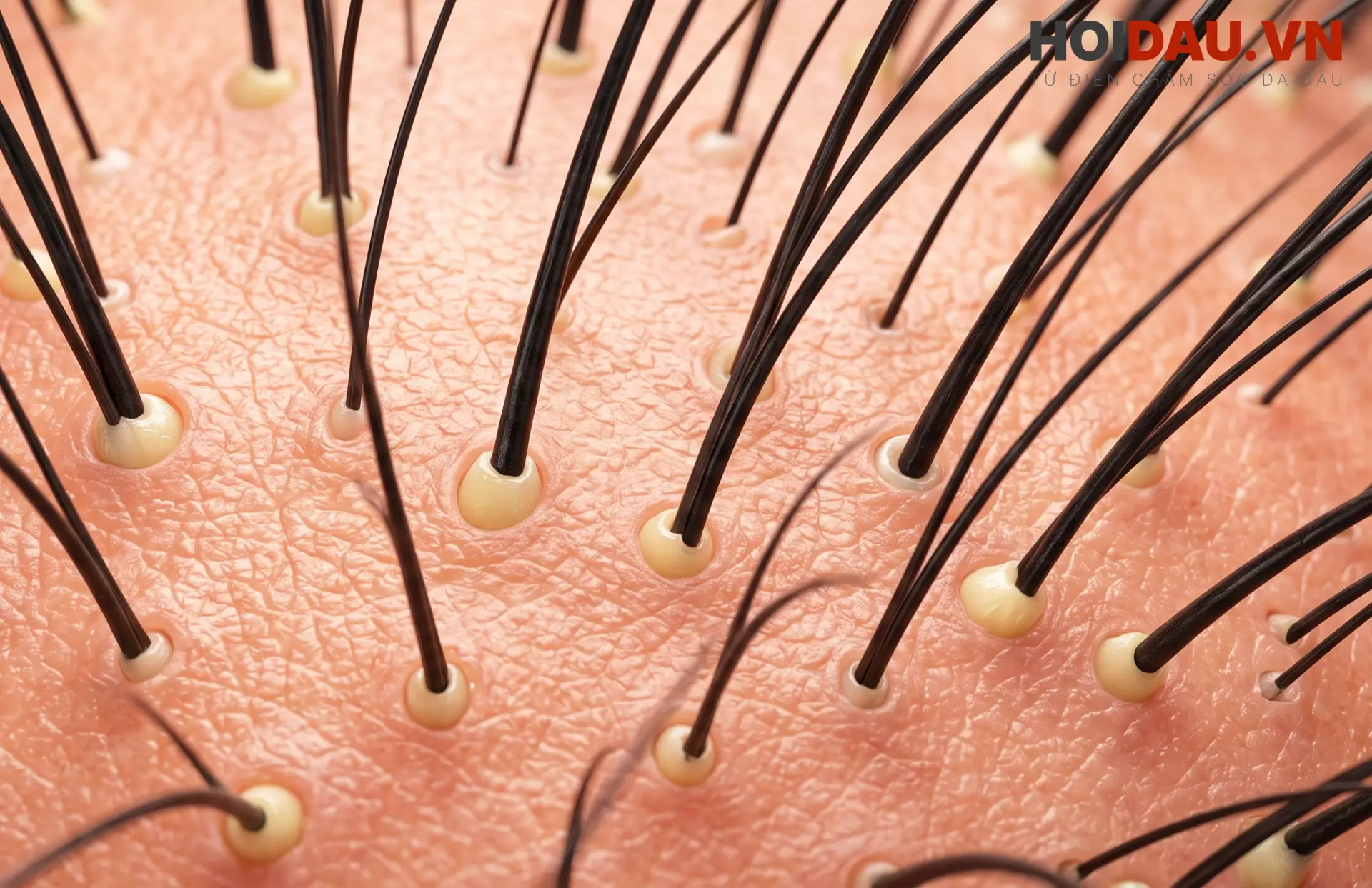 Hoạt chất Minoxidil có tác dụng gì